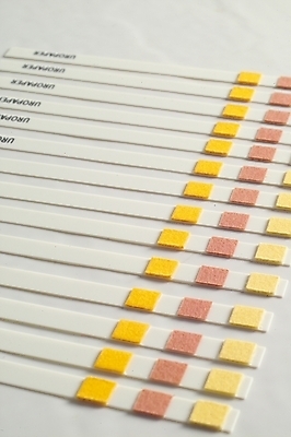 포토 JPG 의학 사람없음 치료 의료용품 오브젝트 시약 소변검사 소변검사시약 종이막대 국내포토 종이 의료기기 약 검사_조사 파일형식