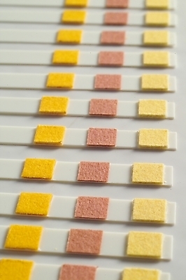 포토 JPG 의학 사람없음 치료 의료용품 오브젝트 시약 소변검사 소변검사시약 종이막대 국내포토 종이 의료기기 약 검사_조사 파일형식