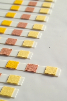 포토 JPG 의학 사람없음 치료 의료용품 오브젝트 시약 소변검사 소변검사시약 종이막대 국내포토 종이 의료기기 약 검사_조사 파일형식