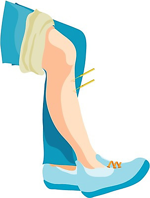 EPS 클립아트 전통 신체 일러스트 의학 의료기기 사람 신체부위 치료 한의학 다리 의료용품 무릎 침술 한방용품 국내일러스트 파일형식 벡터