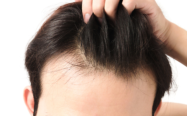 포토 JPG 해외이미지 손 남자 한명 성인 신체부위 뷰티 머리카락 머리 잡기 흰배경 헤어관리 두피관리 두피케어 탈모 탈모클리닉 성인남자한명만 해외202004 탈모예방 해외포토 1 백그라운드 모션 사람 흰색 예방 클리닉 증상 남자한명만 성인남자만 파일형식 이미지허브