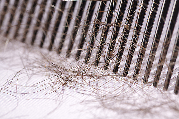 포토 JPG 해외이미지 근접촬영 사람없음 뷰티 머리카락 머리빗 흰배경 헤어관리 탈모 탈모클리닉 해외202004 탈모예방 해외포토 뷰포인트 백그라운드 머리 흰색 미용용품 예방 클리닉 증상 파일형식 이미지허브