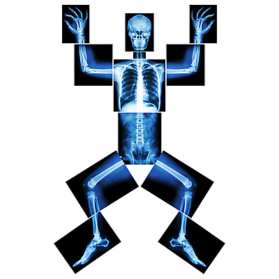 포토 JPG 해외이미지 과학 포즈 신체 해부 뼈 골격 엑스레이 건강 병원 미술 서기 사람 사람없음 약 검은색 고통 환자 의사 광선 흰색 춤 퍼즐 질병 X 생물학 위치 고립 돌봄 방사선 정형외과 해외202004 해외포토 알파벳 교육 감정 컬러 의학 모션 문화예술 의료진 파일형식 이미지허브