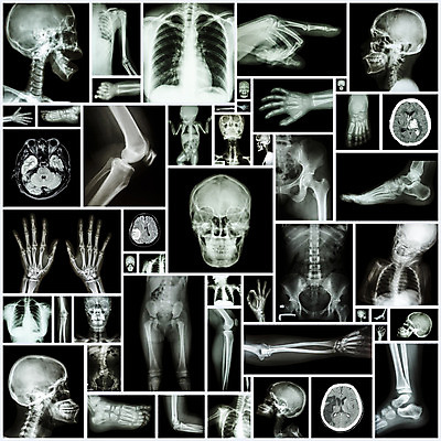 포토 JPG 해외이미지 손 백그라운드 부분 해부 뼈 골격 엑스레이 병원 사람 사람없음 세트 약 고통 환자 의사 광선 그룹 오르간 질병 X 엉덩이 수집 손목 척추 뇌 어깨 무릎 목 팔 외과 발목 궤 양발 정형외과 타격 팔꿈치 해골모형 많음 해외202004 해외포토 알파벳 감정 컨셉 의학 모션 발 신체부위 모형 의료진 건반악기 파일형식 이미지허브