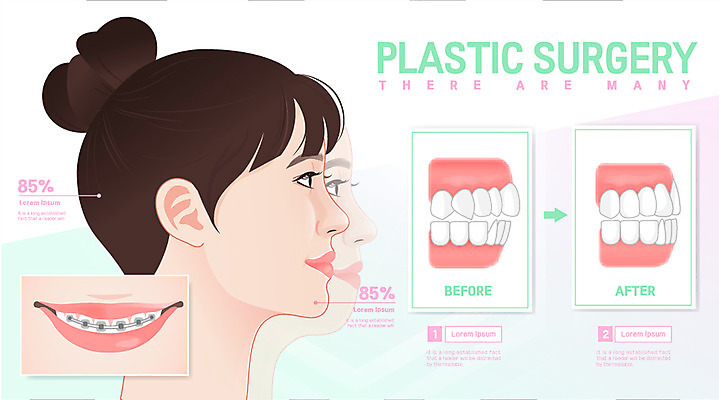 여자 일러스트 한명 상반신 성인 치아 교정 국내일러스트 AI파일 1 사람 소화기관 파일형식 벡터