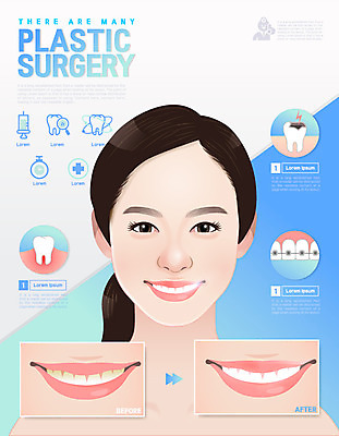 여자 일러스트 한명 상반신 성인 입 치아 교정 클리닉 미백 충치 국내일러스트 AI파일 1 사람 신체부위 소화기관 질병 파일형식 벡터
