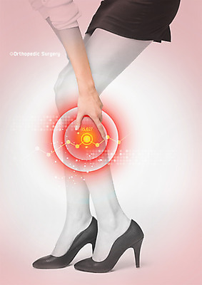 PSD 편집 편집이미지 여자 의학 한명 서기 성인 옆모습 신체부위 치마 고통 다리 하이힐 질병 꺾은선그래프 이미지편집 1 감정 구두 뷰포인트 모션 하의 그래프 사람 여성화 파일형식