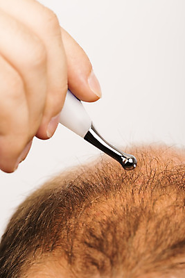 포토 JPG 해외이미지 백인 헤어스타일 남자 얼굴 수염 한명 사람 성인 치료 약 갈색 머리 활발 흰색 점 중앙 정상 자르기 피부 대머리 돌봄 적자 스타일 해외202004 해외포토 서양인 1 컬러 컨셉 의학 모션 신체부위 파일형식 이미지허브