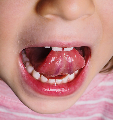 포토 JPG 해외이미지 백인 1 여자 행복 얼굴 어린이 분홍색 셔츠 숙이기 사람 사람없음 흰색 표현 오픈 입 찡그림 치아 혀 스웨터 피부 입술 덮기 보여주기 해외202004 해외포토 서양인 감정 컬러 포즈 상의 모션 표정 신체부위 소화기관 파일형식 이미지허브