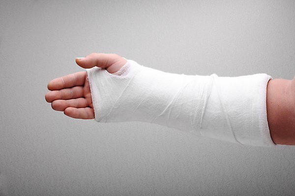 포토 JPG 해외이미지 손 포장 뼈 사람없음 치료 고통 환자 흰색 도움 상처 묶기 사건 붕대 팔 보험 빈털터리 골절 깨짐 석고 정형외과 치유 해외202004 해외포토 감정 컬러 컨셉 의학 모션 병원 신체부위 파일형식 이미지허브