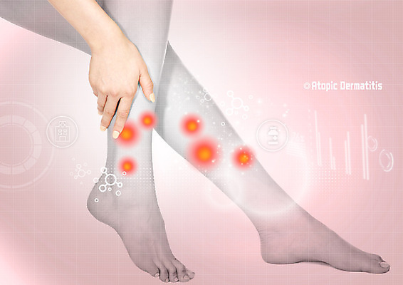 PSD 편집 편집이미지 손 여자 의학 발 건강 신체부위 고통 다리 질병 홀로그램 이미지편집 감정 사람 파일형식