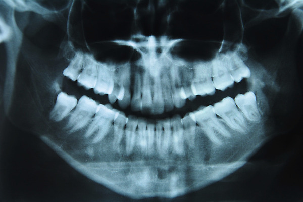 포토 JPG 해외이미지 건강 사람 사람없음 신체부위 건강관리 검은색 장비 흰색 치아 치과의사 치과용품 뿌리 칼슘 해골모형 해외202004 해외포토 컬러 관리 모형 의사 의료용품 소화기관 파일형식 이미지허브