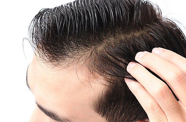 포토 JPG 해외이미지 손 남자 한명 성인 신체부위 뷰티 머리카락 잡기 흰배경 헤어관리 두피관리 두피케어 탈모 탈모클리닉 성인남자한명만 해외202004 탈모예방 숱 해외포토 1 백그라운드 모션 사람 머리 흰색 예방 클리닉 증상 남자한명만 성인남자만 파일형식 이미지허브