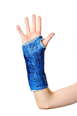 포토 JPG 해외이미지 손 어린이 손가락 뼈 건강 사람없음 치료 파란색 고통 긴급 수리 상처 사건 손목 붕대 팔 깨짐 단절 석고 해외202004 해외포토 감정 컬러 컨셉 의학 사람 신체부위 파일형식 이미지허브