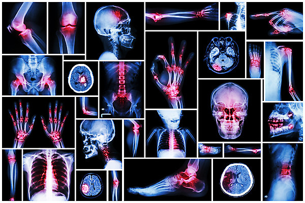 포토 JPG 해외이미지 손 과학 백그라운드 신체 해부 뼈 골격 엑스레이 건강 병원 사람 사람없음 세트 머리 고통 환자 의사 광선 하트 그룹 질병 X 수집 척추 뇌 관절염 무릎 목 팔 외과 발목 궤 방사선 양발 염증 정형외과 타격 해골모형 많음 해외202004 해외포토 모양 알파벳 감정 컨셉 의학 모션 발 신체부위 모형 의료진 파일형식 이미지허브