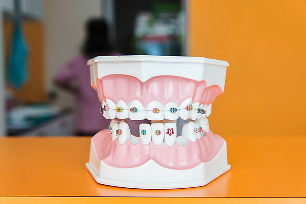 포토 JPG 해외이미지 일러스트 치과 미소 사람없음 빛 약 금속 입 치아 치과의사 위생관리 직진 해외202004 해외포토 의학 재질 표정 병원 관리 신체부위 의사 소화기관 파일형식 이미지허브