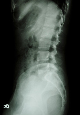 포토 JPG 해외이미지 과학 백그라운드 신체 해부 바닥 뼈 골격 엑스레이 건강 병원 사람 성인 사람없음 옆모습 약 검은색 고통 환자 의사 광선 흰색 질병 X 엉덩이 흉부 필름 허리 척추 당나귀 외과 방사선 정형외과 해외202004 해외포토 알파벳 감정 뷰포인트 컬러 의학 신체부위 의료진 말_동물 호흡기관 파일형식 이미지허브