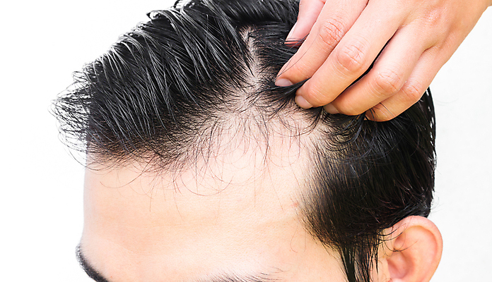 포토 JPG 해외이미지 손 남자 한명 근접촬영 성인 신체부위 뷰티 머리카락 머리 흰배경 헤어관리 두피관리 두피케어 탈모 탈모클리닉 성인남자한명만 해외202004 탈모예방 숱 해외포토 1 뷰포인트 백그라운드 사람 흰색 예방 클리닉 증상 남자한명만 성인남자만 파일형식 이미지허브