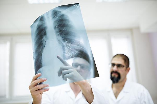 포토 JPG 서양인 외국인 남자 의학 엑스레이 실내 병원 서기 들기 상반신 20대 성인 두명 앞모습 아웃포커스 30대 의사 가리킴 국내포토 뷰포인트 모션 촬영기법 사람 인종 손짓 청년 내부 장년 의료진 파일형식