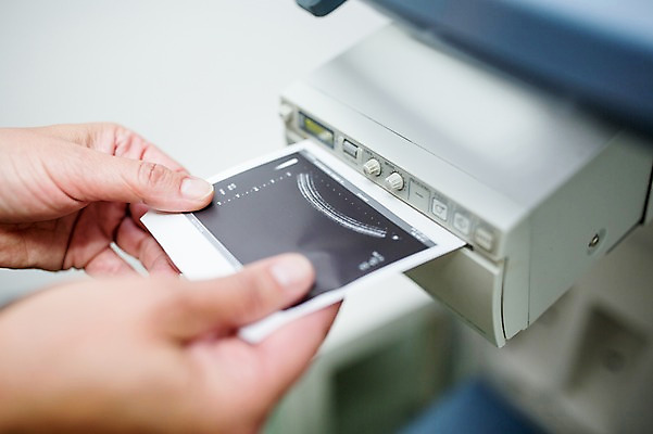 포토 JPG 외국인 손 의학 의료기기 실내 한명 아웃포커스 신체부위 30대 기계 초음파 초음파검사 초음파사진 국내포토 1 촬영기법 사람 인종 내부 장년 검사_조사 파일형식