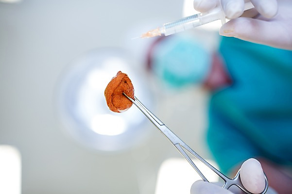 포토 JPG 서양인 외국인 여자 로우앵글 중년 50대 의학 실내 병원 주사기 마스크 한명 상반신 성인 앞모습 아웃포커스 의사 수술 수술복 수술실 수술도구 거즈 국내포토 1 뷰포인트 의료기기 촬영기법 사람 인종 내부 치료 의료진 의학용품 가운 파일형식