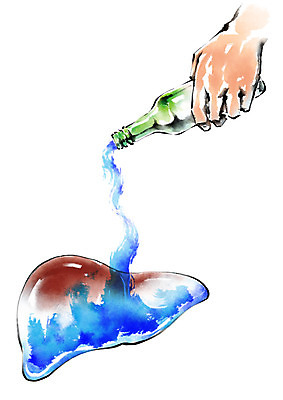 PSD 손 일러스트 캘리그라피 건강 붓기 질병 간 소주 소주병 간암 국내일러스트 의학 모션 술병 주류 신체부위 장기_의학 암 파일형식