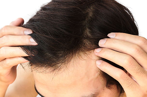 포토 JPG 해외이미지 손 남자 한명 성인 신체부위 뷰티 머리카락 머리 흰배경 헤어관리 두피관리 두피케어 탈모 탈모클리닉 성인남자한명만 해외202004 탈모예방 숱 해외포토 1 백그라운드 사람 흰색 예방 클리닉 증상 남자한명만 성인남자만 파일형식 이미지허브