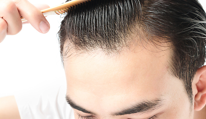 포토 JPG 해외이미지 남자 한명 들기 근접촬영 성인 뷰티 머리카락 머리 머리빗 흰배경 헤어관리 두피관리 두피케어 탈모 탈모클리닉 성인남자한명만 해외202004 탈모예방 숱 해외포토 1 뷰포인트 백그라운드 모션 사람 신체부위 흰색 미용용품 예방 클리닉 증상 남자한명만 성인남자만 파일형식 이미지허브