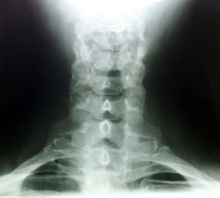 포토 JPG 해외이미지 뼈 건강 병원 사람 사람없음 약 검은색 시험 환자 의사 흰색 지압 척추 생물학 목 해외202004 해외포토 교육 컬러 의학 신체부위 의료진 마사지 파일형식 이미지허브