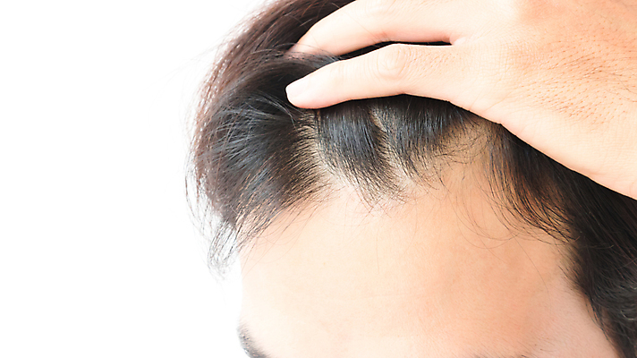 포토 JPG 해외이미지 손 남자 한명 상반신 성인 신체부위 뷰티 머리카락 머리 흰배경 헤어관리 감싸기 두피관리 두피케어 탈모 탈모클리닉 성인남자한명만 해외202004 탈모예방 숱 해외포토 1 백그라운드 모션 사람 흰색 예방 클리닉 증상 남자한명만 성인남자만 파일형식 이미지허브