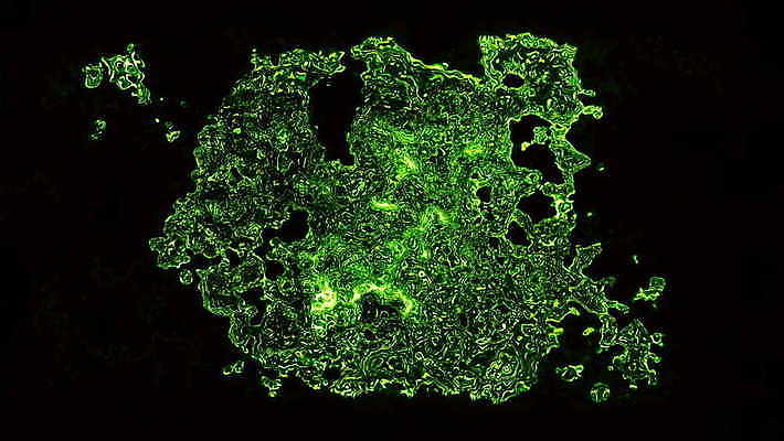포토 JPG 해외이미지 백그라운드 검은배경 세포 건강 현미경 사람없음 초록색 3D 바이러스 질병 감염 미생물 분열 박테리아 분할 전염병 코로나바이러스 해외202004 해외포토 컬러 의학 생물 실험기구 검은색 디지털합성 파일형식 이미지허브
