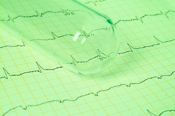 포토 JPG 의학 의료기기 그래프 실험기구 사람없음 치료 의료용품 화학 오브젝트 시험관 유리관 화학실험 국내포토 과학 실험 파일형식