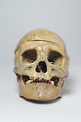 포토 JPG 신체 의학 뼈 해골 사람 사람없음 치료 의료용품 장기 근골격기관 국내포토 의료기기 장기_의학 파일형식