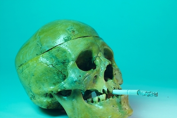 포토 JPG 신체 의학 뼈 해골 흡연 담배 사람 사람없음 치료 의료용품 장기 근골격기관 국내포토 의료기기 장기_의학 파일형식