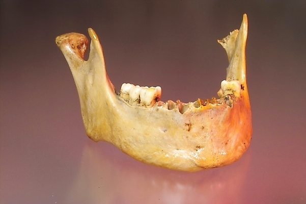 포토 JPG 신체 의학 뼈 해골 사람 사람없음 치료 의료용품 치아 장기 근골격기관 오브젝트 턱 턱뼈 국내포토 의료기기 소화기관 장기_의학 파일형식