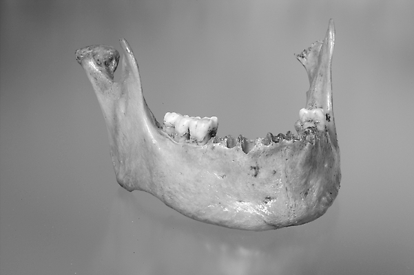 포토 JPG 신체 의학 뼈 해골 사람 사람없음 치료 의료용품 치아 장기 근골격기관 오브젝트 턱 턱뼈 국내포토 의료기기 소화기관 장기_의학 파일형식