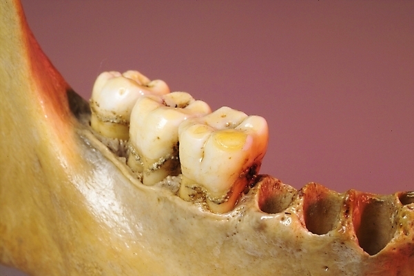 포토 JPG 신체 의학 뼈 해골 사람 사람없음 치료 의료용품 치아 장기 근골격기관 오브젝트 국내포토 의료기기 소화기관 장기_의학 파일형식