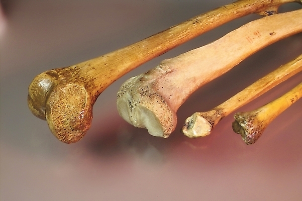 포토 JPG 신체 의학 뼈 사람 사람없음 치료 의료용품 장기 근골격기관 오브젝트 국내포토 의료기기 장기_의학 파일형식