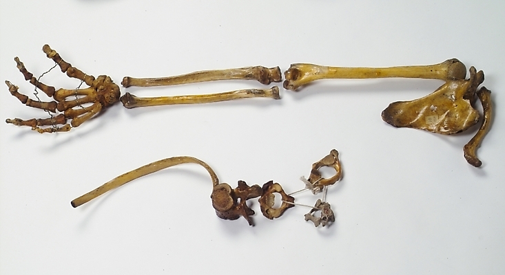 포토 JPG 손 신체 의학 뼈 해골 사람 사람없음 치료 의료용품 장기 근골격기관 오브젝트 의료소품 국내포토 의료기기 신체부위 장기_의학 파일형식