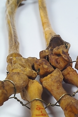 포토 JPG 신체 의학 뼈 사람 사람없음 치료 의료용품 장기 근골격기관 오브젝트 국내포토 의료기기 장기_의학 파일형식