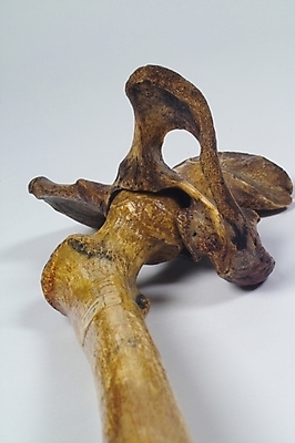 포토 JPG 신체 의학 뼈 사람 사람없음 치료 의료용품 장기 근골격기관 오브젝트 국내포토 의료기기 장기_의학 파일형식