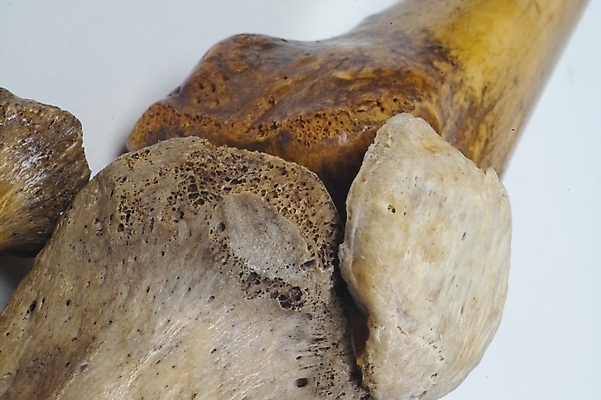 포토 JPG 신체 의학 뼈 사람 사람없음 치료 의료용품 장기 근골격기관 오브젝트 국내포토 의료기기 장기_의학 파일형식