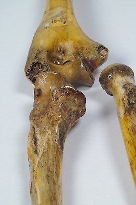 포토 JPG 신체 의학 뼈 사람 사람없음 치료 의료용품 장기 근골격기관 오브젝트 국내포토 의료기기 장기_의학 파일형식