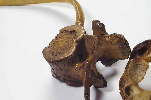 포토 JPG 신체 의학 뼈 사람 사람없음 치료 의료용품 장기 근골격기관 오브젝트 국내포토 의료기기 장기_의학 파일형식