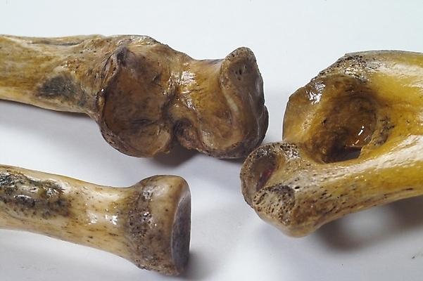 포토 JPG 신체 의학 뼈 사람 사람없음 치료 의료용품 장기 근골격기관 오브젝트 국내포토 의료기기 장기_의학 파일형식