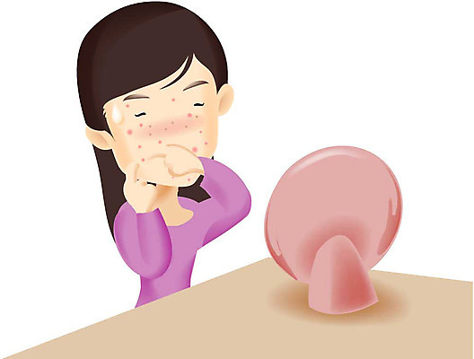 EPS 여자 일러스트 의학 병원 한명 사람 20대 성인 치료 뷰티 거울 환자 성형수술 고민 성형외과 여드름 망설임 여자만 여자한명만 성인여자만 청년만 청년여자만 성인한명만 청년여자한명만 성인여자한명만 성인만 국내일러스트 1 감정 청년 수술 파일형식 벡터