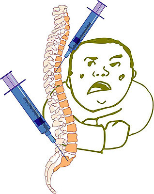 EPS 클립아트 남자 일러스트 해부 의학 인체모형 뼈 주사기 한명 사람 20대 성인 치료 의료용품 무서움 척추 오브젝트 척추모형 척추해부도 남자만 남자한명만 성인남자만 청년만 청년남자만 청년남자한명만 성인한명만 성인남자한명만 성인만 국내일러스트 1 감정 의료기기 청년 모형 파일형식 벡터