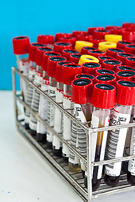 포토 JPG 해외이미지 과학 백그라운드 유리 병원 실험 사람없음 물 빛 약 금속 여러개 장비 간호사 의사 흰색 기구 투명 액체 실험실 콘센트 질병 생명공학 플라스틱 약국 과학자 생물학 미생물 튜브 유지 조제 고립 신발장 화학물질 공급 해외202004 해외포토 자연요소 직업 교육 컬러 다수 의학 재질 생물 의료진 화학 만들기 학자 파일형식 이미지허브