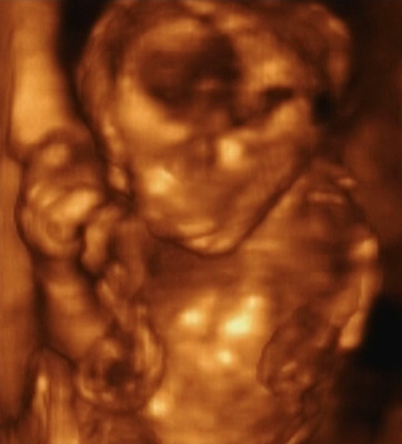 포토 JPG 해외이미지 백인 손 장갑 2 건강 병원 사람 성인 사람없음 스터디 약 기계 소리 임신 장비 환자 의사 탐험 공구 침대 아기 플랫 질병 분석 점검 돌봄 레이더 스캐너 스캔 제어 헬프 해외202004 해외포토 서양인 잡화 가구 컨셉 의학 모션 신체부위 학습 의료진 도구 도움 파일형식 이미지허브