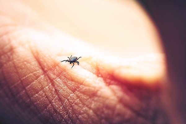 포토 JPG 해외이미지 동물 1 손 곤충 손바닥 사람없음 고통 닫기 해충 벌레 지저분함 핥기 질병 위험 피부 묘사 싱글 생물학 감염 전염 토막 기생충 기어가기 동물상 못생김 해외202004 해외포토 교육 감정 컨셉 의학 모션 신체부위 조형물 감각 바이러스 파일형식 이미지허브